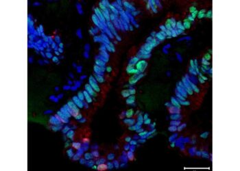 Consente di avere immagini tridimensionali campioni cellulari