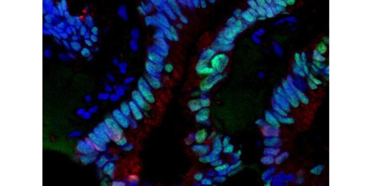 Consente di avere immagini tridimensionali campioni cellulari