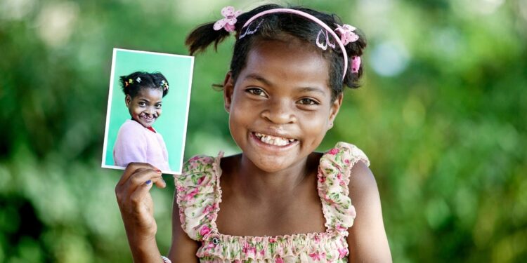 Per curare migliaia di bambini con malformazioni del volto